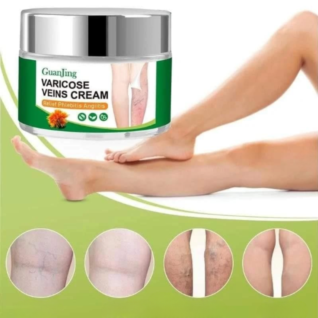 Crema para Várices y Piernas Cansadas | VeinRelief®