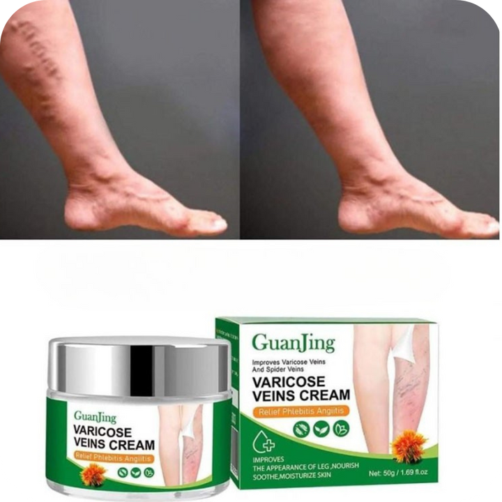 Crema para Várices y Piernas Cansadas | VeinRelief®
