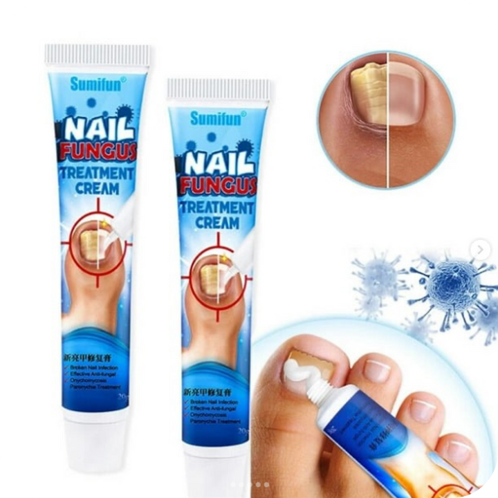 Crema Anti Hongos para los Pies | NailFungus®